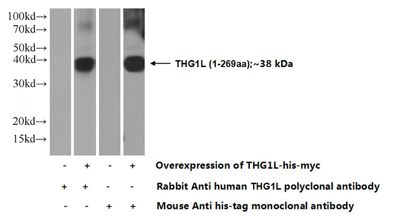 Transfected HEK-293 cells were subjected to SDS PAGE followed by western blot with Catalog No:116043(THG1L Antibody) at dilution of 1:2000
