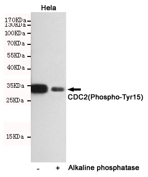 Western blot detection of CDC2(Phospho-Tyr15) in Hela cells untreated or treated with Alkaline phosphatase using CDC2(Phospho-Tyr15) Rabbit pAb (dilution 1:1000).Predicted band size:34kDa.Observed band size:34kDa.