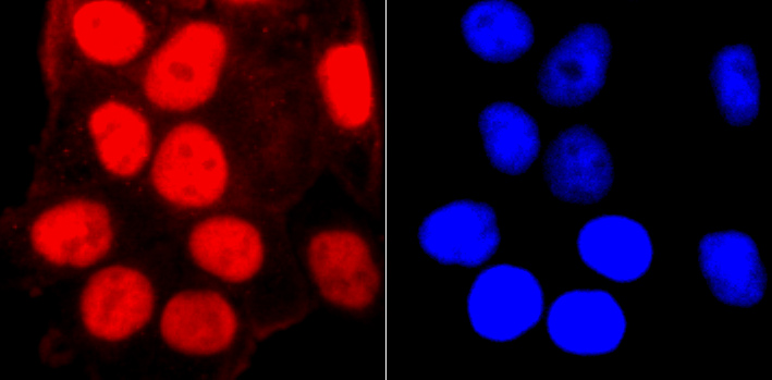Fig2: ICC staining SMC3 in Hela cells (red). The nuclear counter stain is DAPI (blue). Cells were fixed in paraformaldehyde, permeabilised with 0.25% Triton X100/PBS.