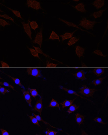 Immunofluorescence - SERPINA10 Polyclonal Antibody 