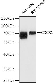 Western blot - CXCR1 Polyclonal Antibody 