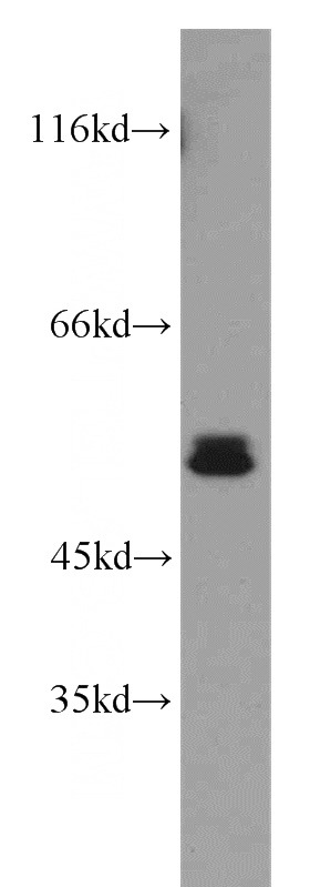 Y79 cells were subjected to SDS PAGE followed by western blot with Catalog No:114789(RORB antibody) at dilution of 1:800