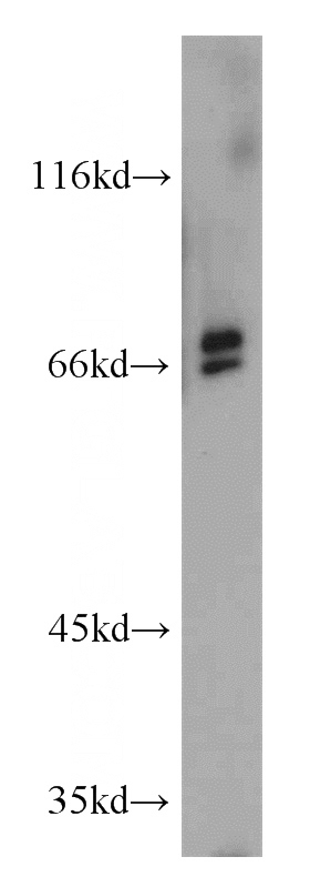 mouse ovary tissue were subjected to SDS PAGE followed by western blot with Catalog No:107991(AMH antibody) at dilution of 1:300
