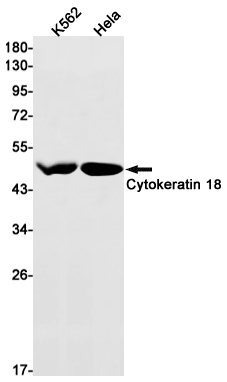 Western blot detection of Cytokeratin 18 in K562,Hela cell lysates using Cytokeratin 18 Rabbit mAb(1:1000 diluted).Predicted band size:48kDa.Observed band size:48kDa.