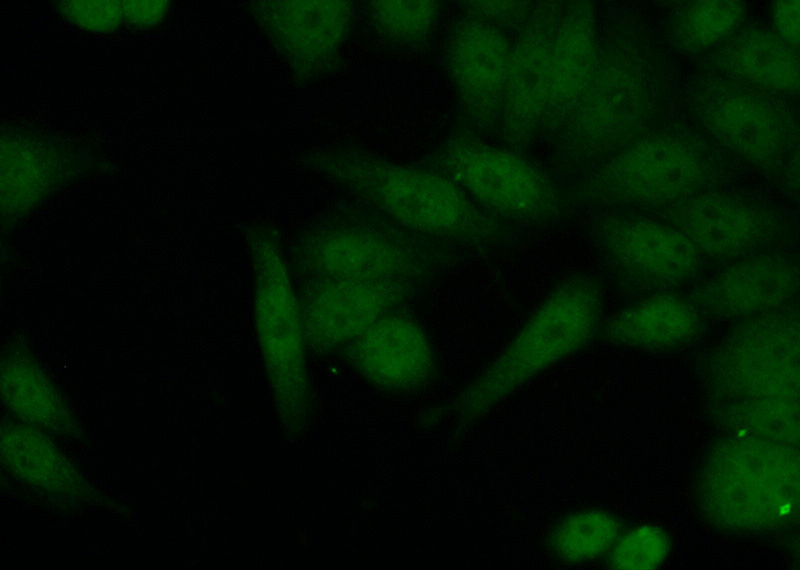 Immunofluorescent analysis of (10% Formaldehyde) fixed HeLa cells using Catalog No:110664(FIGNL1 Antibody) at dilution of 1:50 and Alexa Fluor 488-congugated AffiniPure Goat Anti-Rabbit IgG(H+L)