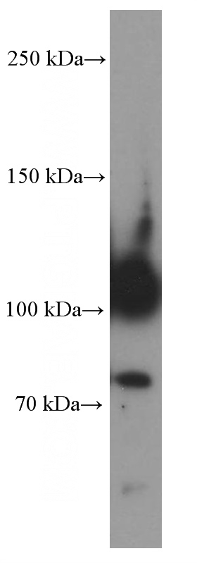 human placenta tissue were subjected to SDS PAGE followed by western blot with Catalog No:107132(CD34 Antibody) at dilution of 1:1000
