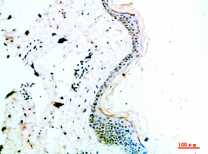 Fig1:; Immunohistochemical analysis of paraffin-embedded human-skin, antibody was diluted at 1:200
