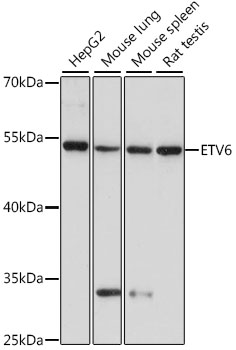 Western blot - ETV6 Polyclonal Antibody 