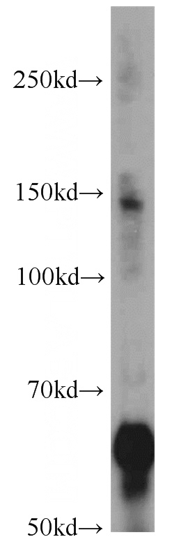 mouse brain tissue were subjected to SDS PAGE followed by western blot with Catalog No:113162(NEFL antibody) at dilution of 1:4000