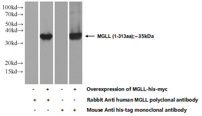 Transfected HEK-293 cells were subjected to SDS PAGE followed by western blot with Catalog No:112599(MGLL Antibody) at dilution of 1:1000