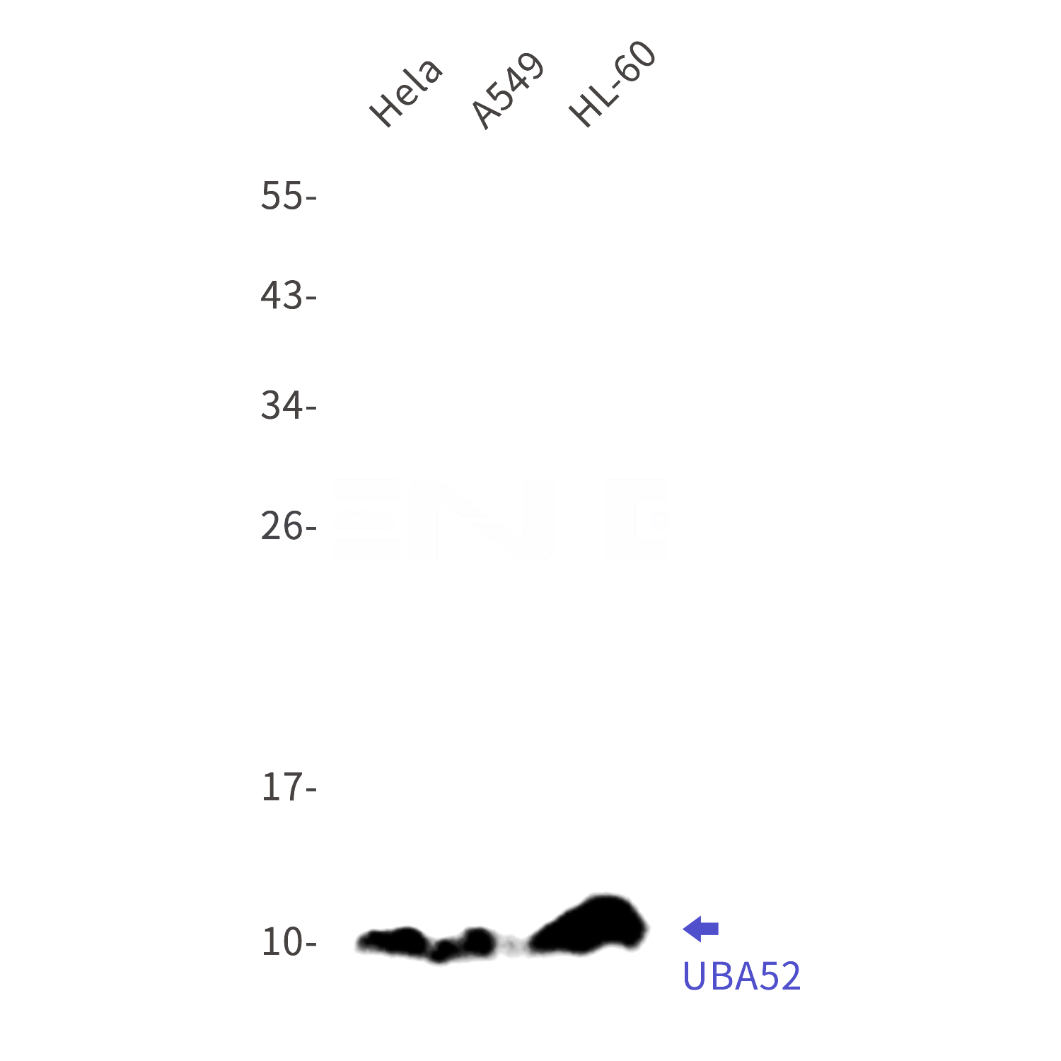 Western blot detection of UBA52 in Hela,A549,HL-60 cell lysates using UBA52 Rabbit mAb(1:1000 diluted).Predicted band size:15kDa.Observed band size:10kDa.