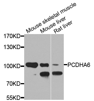 Western blot - PCDHA6 Polyclonal Antibody 