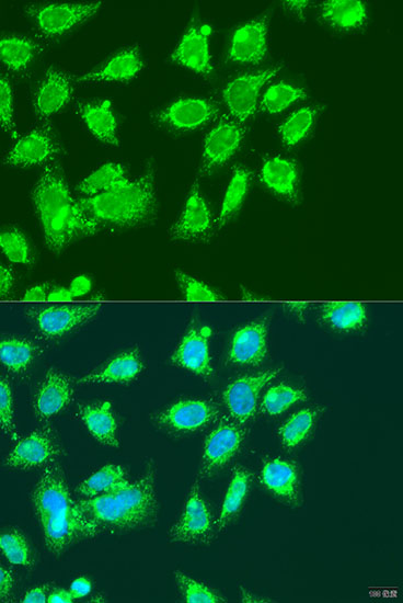Immunofluorescence - MCCC2 Polyclonal Antibody 