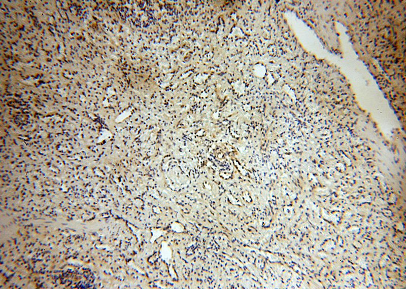Immunohistochemical of paraffin-embedded human spleen using Catalog No:107814(ABHD2 antibody) at dilution of 1:100 (under 10x lens)