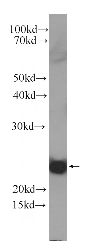 Recombinant protein were subjected to SDS PAGE followed by western blot with Catalog No:107387(IL1F10 Antibody) at dilution of 1:1000