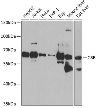 Western blot - C8B Polyclonal Antibody 