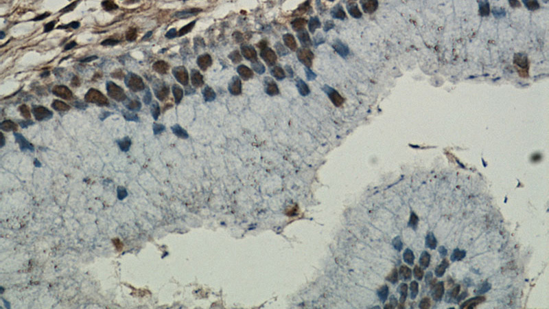 Immunohistochemical of paraffin-embedded human cervix using Catalog No:110476(ESR2 Beta-6 antibody) at dilution of 1:50 (under 40x lens)