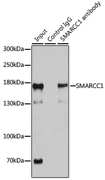 Immunoprecipitation - SMARCC1 Polyclonal Antibody 