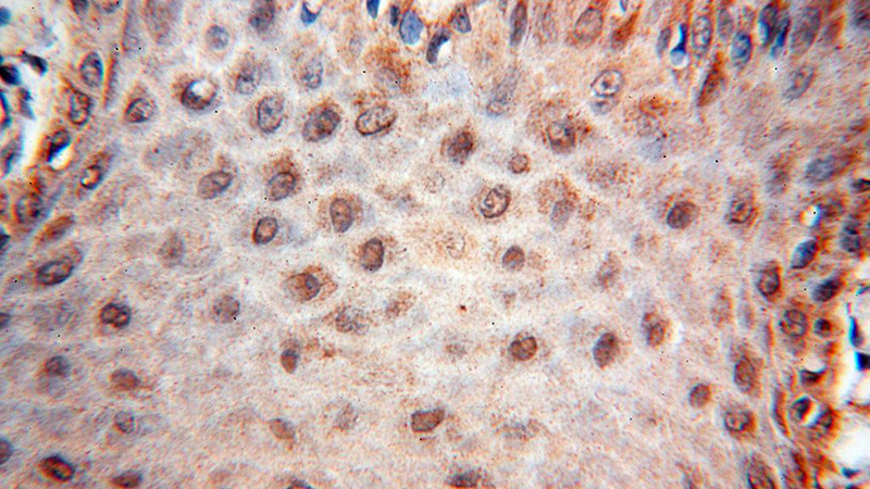 Immunohistochemical of paraffin-embedded human skin using Catalog No:116666(UBXN6 antibody) at dilution of 1:100 (under 40x lens)