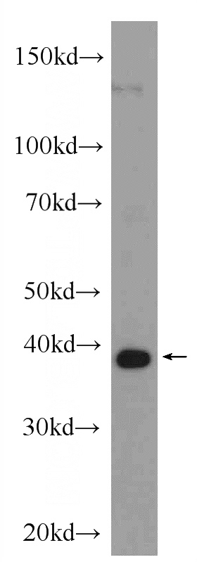 HEK-293 cells were subjected to SDS PAGE followed by western blot with Catalog No:111939(ISG20L2 Antibody) at dilution of 1:1000