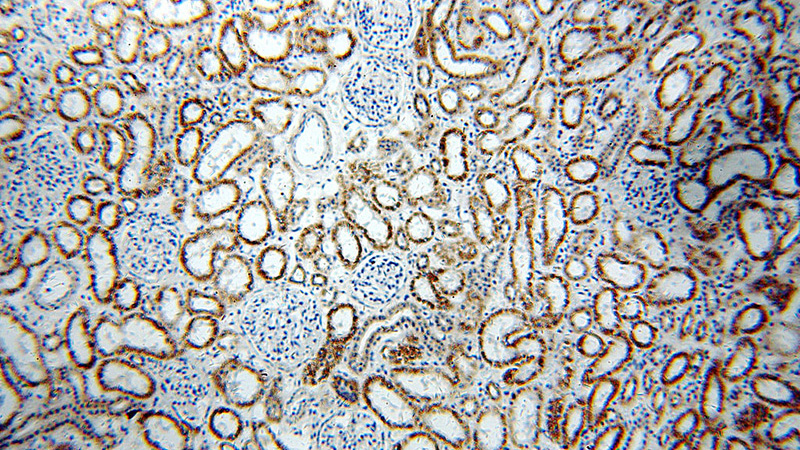 Immunohistochemical of paraffin-embedded human kidney using Catalog No:107973(ALDH6A1 antibody) at dilution of 1:50 (under 10x lens)