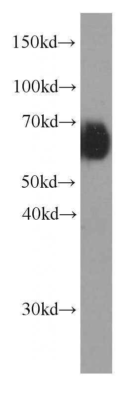 human blood tissue were subjected to SDS PAGE followed by western blot with Catalog No:107363(KNG1 antibody) at dilution of 1:5000