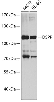 Western blot - DSPP Polyclonal Antibody 