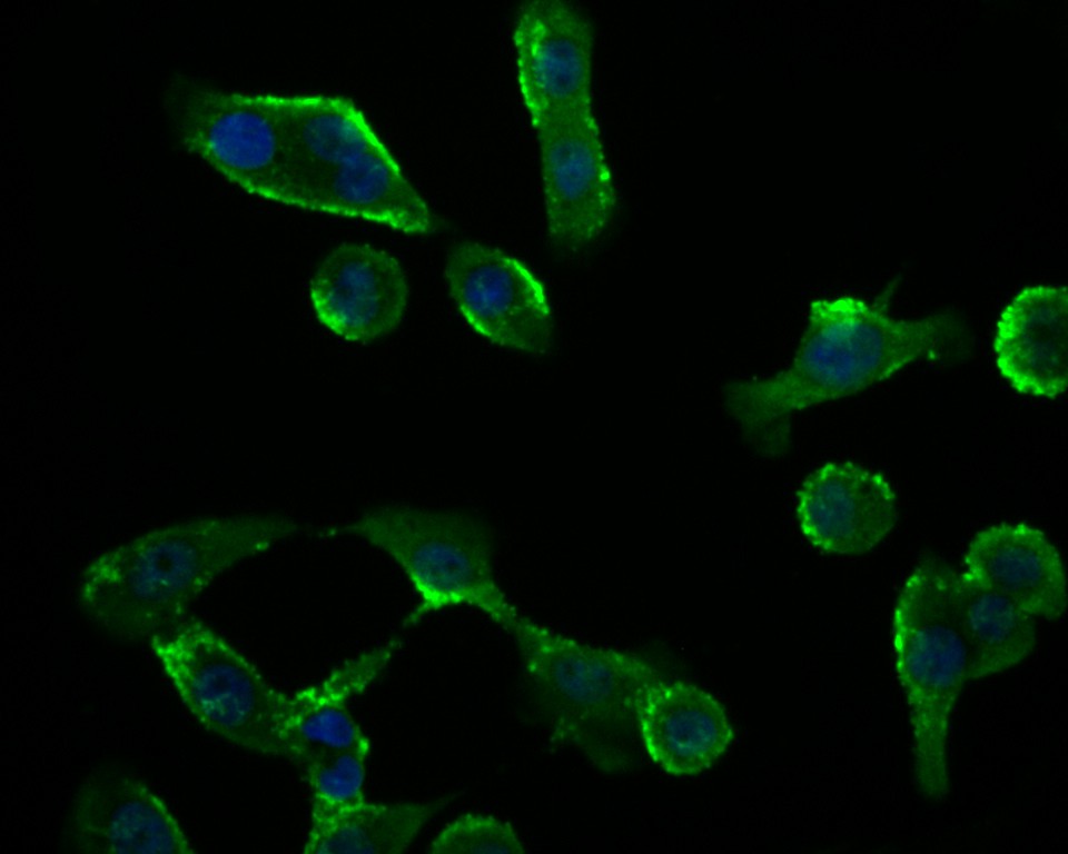 Fig2: ICC staining RYR3 in Lovo cells (green). Formalin fixed cells were permeabilized with 0.1% Triton X-100 in TBS for 10 minutes at room temperature and blocked with 1% Blocker BSA for 15 minutes at room temperature. Cells were probed with the antibody at a dilution of 1:200 for 1 hour at room temperature, washed with PBS. Alexa Fluorc™ 488 Goat anti-Rabbit IgG was used as the secondary antibody at 1/100 dilution. The nuclear counter stain is DAPI (blue).