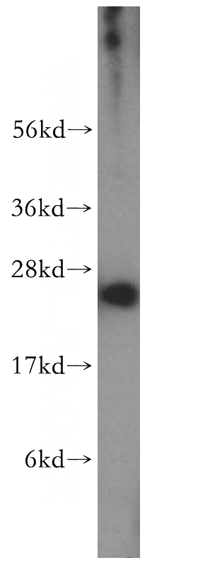 K-562 cells were subjected to SDS PAGE followed by western blot with Catalog No:114426(RAB27A-specific antibody) at dilution of 1:300