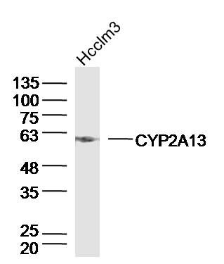 Fig1: Sample:Hcclm3 Cell (Human) Lysate at 40 ug; Primary: Anti-CYP2A13 at 1/300 dilution; Secondary: IRDye800CW Goat Anti-Rabbit IgG at 1/20000 dilution; Predicted band size: 57kD; Observed band size: 57kD