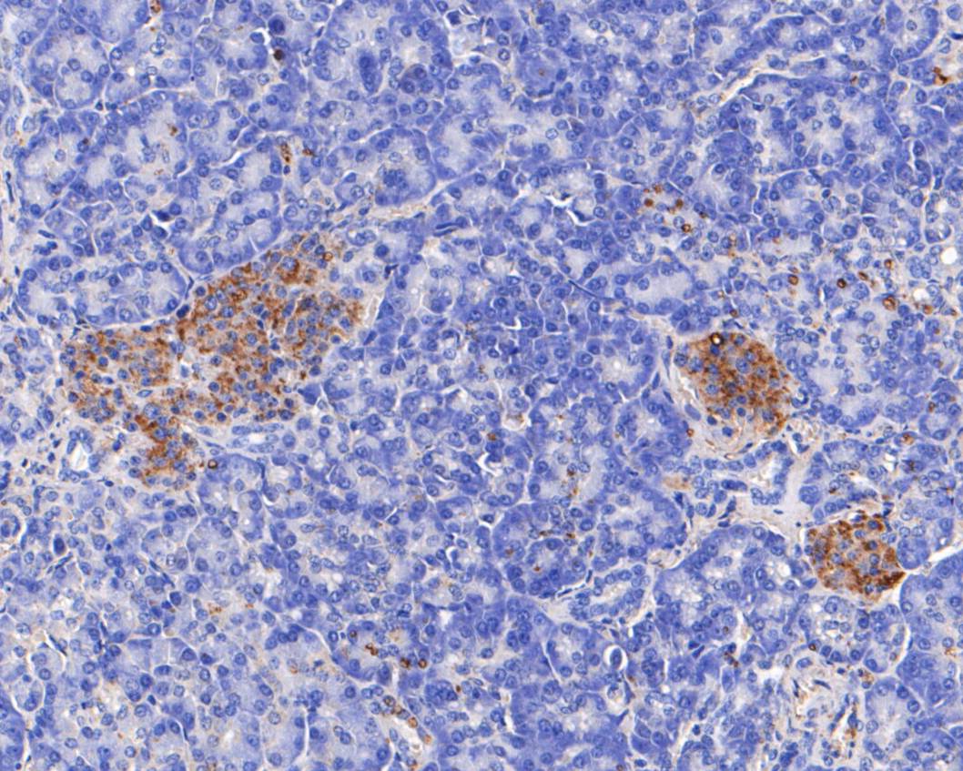 Fig3: Immunohistochemical analysis of paraffin-embedded human pancreas tissue using anti-TRIM72 antibody. The section was pre-treated using heat mediated antigen retrieval with Tris-EDTA buffer (pH 8.0-8.4) for 20 minutes.The tissues were blocked in 5% BSA for 30 minutes at room temperature, washed with ddH2O and PBS, and then probed with the primary antibody ( 1/200) for 30 minutes at room temperature. The detection was performed using an HRP conjugated compact polymer system. DAB was used as the chromogen. Tissues were counterstained with hematoxylin and mounted with DPX.
