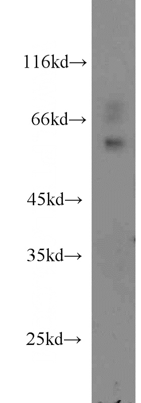 RAW264.7 cells were subjected to SDS PAGE followed by western blot with Catalog No:115434(SMARCD2 antibody) at dilution of 1:500
