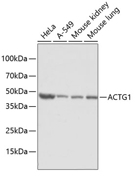 Western blot - ACTG1 Polyclonal Antibody 