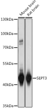 Western blot - SEPT3 Polyclonal Antibody 