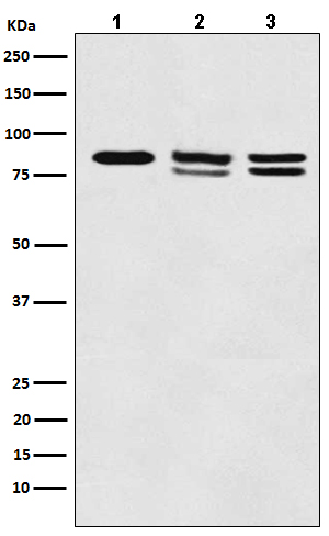 Western blot analysis of IKK alpha+beta expression in (1) A431 cell lysate; (2) 293T cell lysate; (3) Mouse kidney lysate.