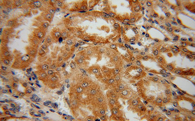 Immunohistochemical of paraffin-embedded human kidney using Catalog No:111147(GPT2 antibody) at dilution of 1:100 (under 40x lens)