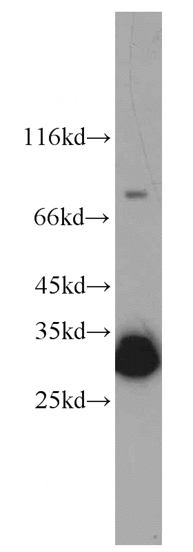 mouse testis tissue were subjected to SDS PAGE followed by western blot with Catalog No:115017(SYCP3 antibody) at dilution of 1:1000