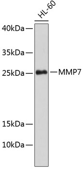 Western blot - MMP7 Polyclonal Antibody 