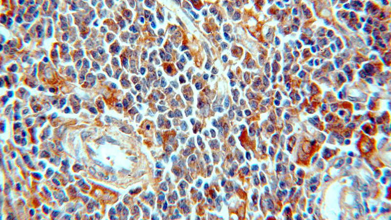 Immunohistochemical of paraffin-embedded human spleen using Catalog No:113487(PAFAH1B3 antibody) at dilution of 1:50 (under 40x lens)
