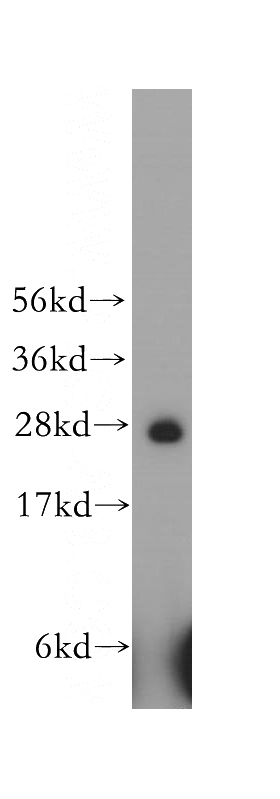 human liver tissue were subjected to SDS PAGE followed by western blot with Catalog No:111469(HS2ST1 antibody) at dilution of 1:500