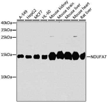 Western blot - NDUFA7 Polyclonal Antibody 