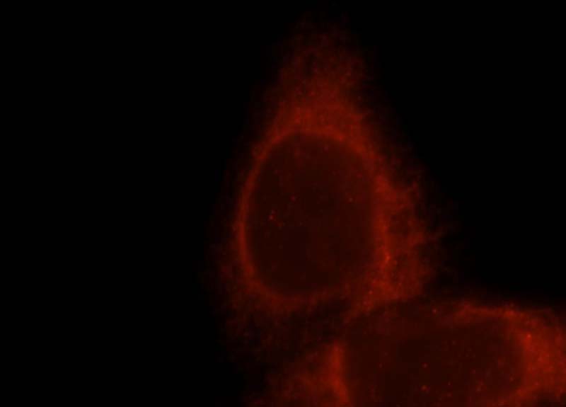 Immunofluorescent analysis of Hela cells, using TRPV6 antibody Catalog No:116419 at 1:25 dilution and Rhodamine-labeled goat anti-rabbit IgG (red).