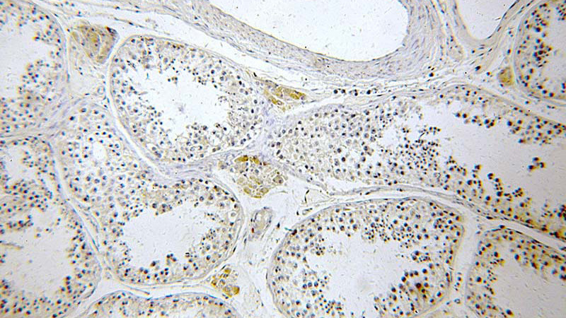 Immunohistochemical of paraffin-embedded human testis using Catalog No:112348(LSM14A antibody) at dilution of 1:100 (under 10x lens)