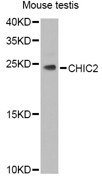 Western blot - CHIC2 Polyclonal Antibody 