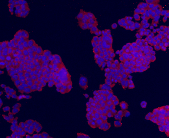 Fig2: ICC staining Transmembrane protein 200A (red) in F9 cells. The nuclear counter stain is DAPI (blue). Cells were fixed in paraformaldehyde, permeabilised with 0.25% Triton X100/PBS.