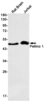 Western blot detection of Pellino 1 in Rat Brain,Jurkat cell lysates using Pellino 1 Rabbit mAb(1:500 diluted).Predicted band size:46kDa.Observed band size:46kDa.