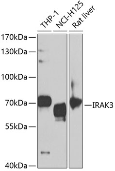 Western blot - IRAK3 Polyclonal Antibody 