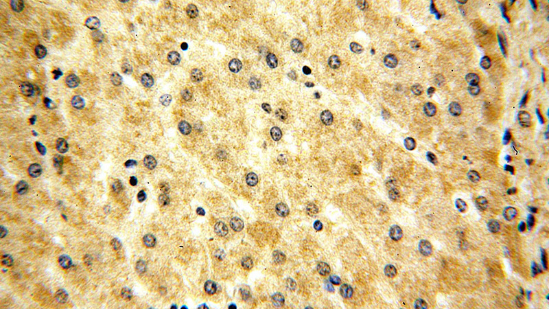 Immunohistochemical of paraffin-embedded human liver using Catalog No:110105(DNAJC15 antibody) at dilution of 1:100 (under 40x lens)