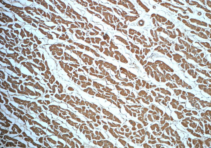 Immunohistochemistry of paraffin-embedded human heart slide using Catalog No:111603(IDH2 Antibody) at dilution of 1:50