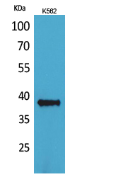 Fig1:; Western Blot analysis of K562 cells using CD1C Polyclonal Antibody.. Secondary antibody（catalog#：HA1001) was diluted at 1:20000